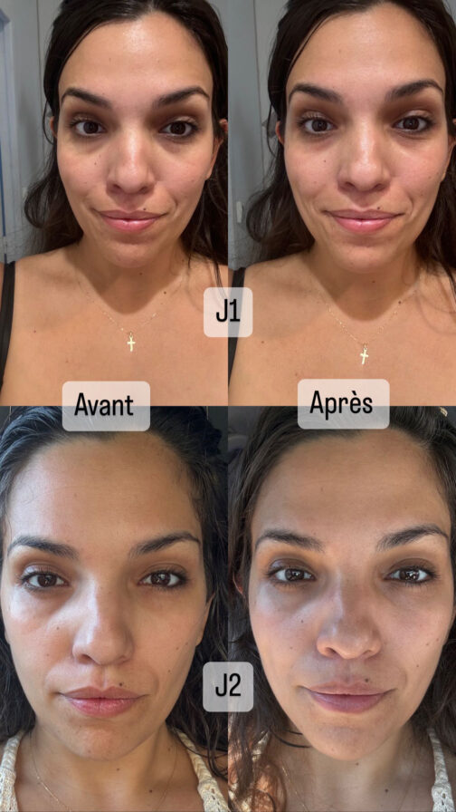 soin contour des yeux poches cernes rides hydratation yeux naturel cosmétique marseille